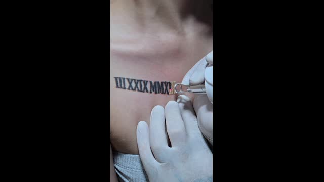 Tattoo removal