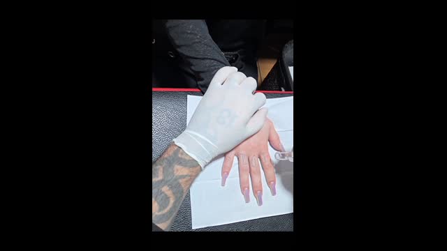 Tattoo removal
